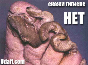ногти