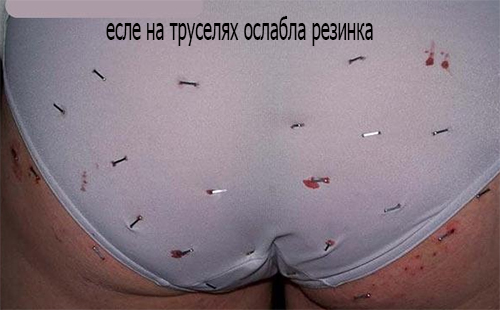 резинка на труселях